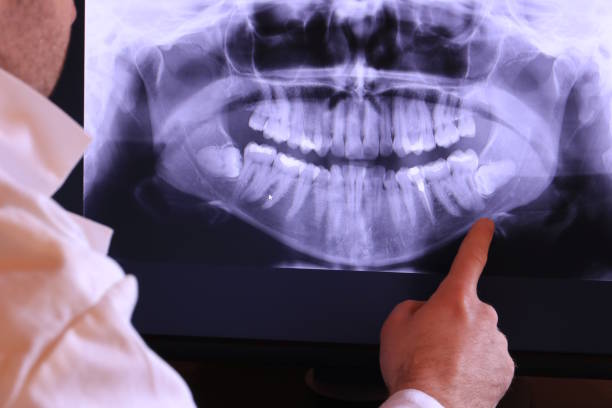 Best Emergency Tooth Extraction in St Charles, IL